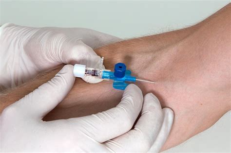  iv|Intravenous injection: Uses, equipment, sites, and more